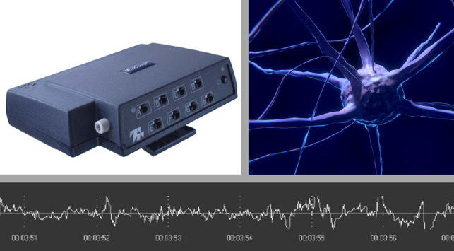 Neurofeedback