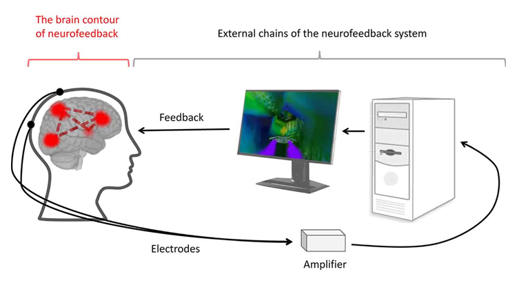 Neurofeedback