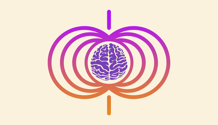 Estimulación Magenética Transcraneal